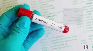 Anthrax Outbreak Confirmed in Zamfara